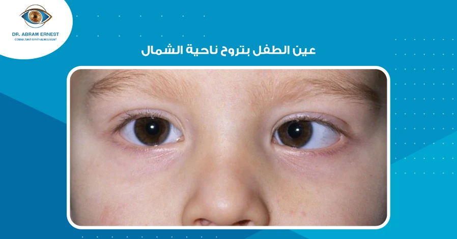 عين الطفل بتروح ناحية الشمال
