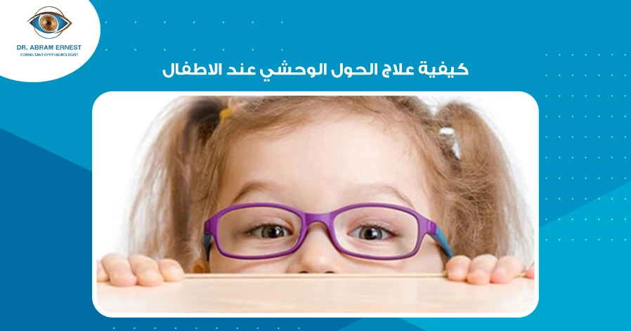 كيفية علاج الحول الوحشي عند الاطفال