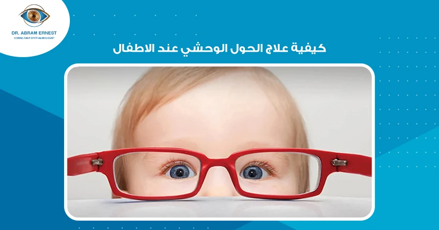 كيفية علاج الحول الوحشي عند الاطفال