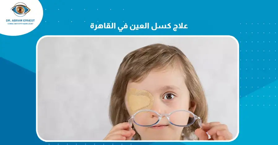 علاج كسل العين في القاهرة