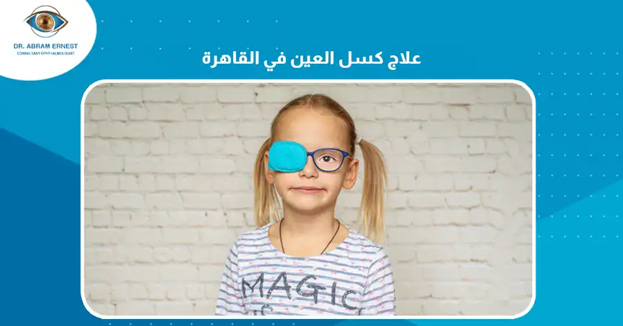 علاج كسل العين في القاهرة