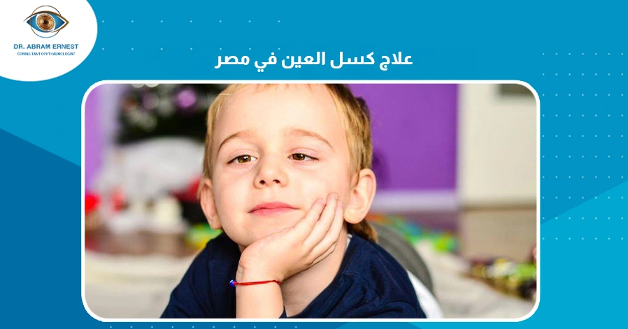 علاج كسل العين في مصر