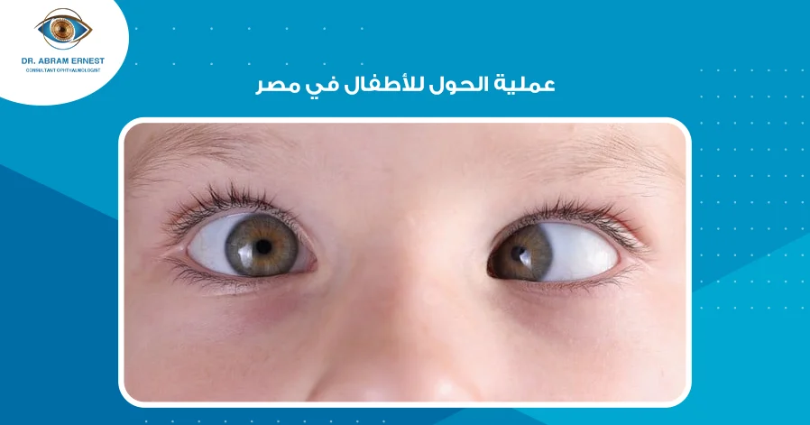 عملية الحول للأطفال في مصر