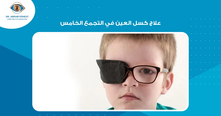 علاج كسل العين في التجمع الخامس