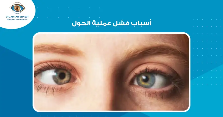 أسباب فشل عملية الحول 