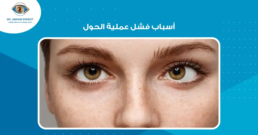 أسباب فشل عملية الحول 