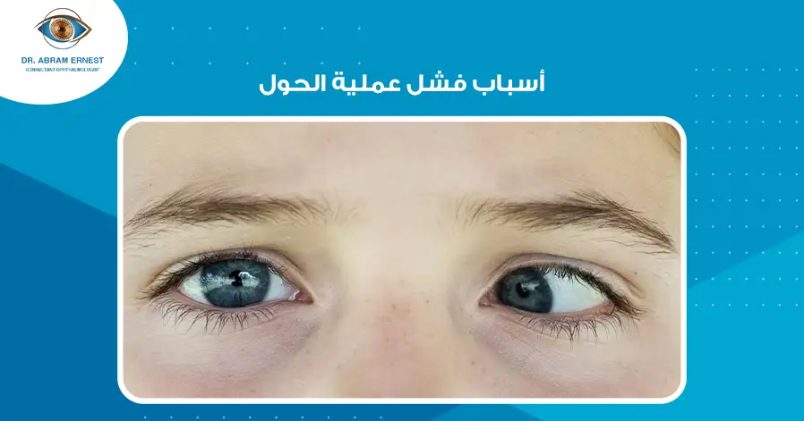 أسباب فشل عملية الحول 