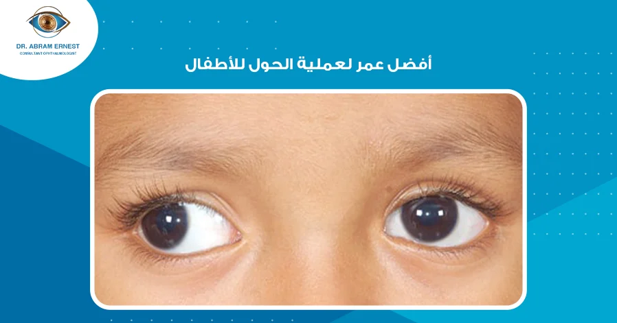 أفضل عمر لعملية الحول للأطفال