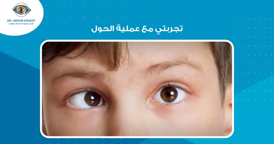 تجربتي مع عملية الحول