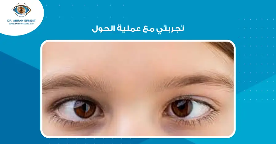 تجربتي مع عملية الحول