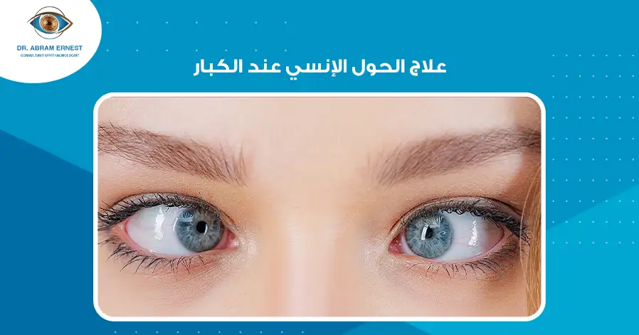 علاج الحول الإنسي عند الكبار