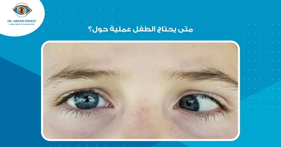 متى يحتاج الطفل عملية حول
