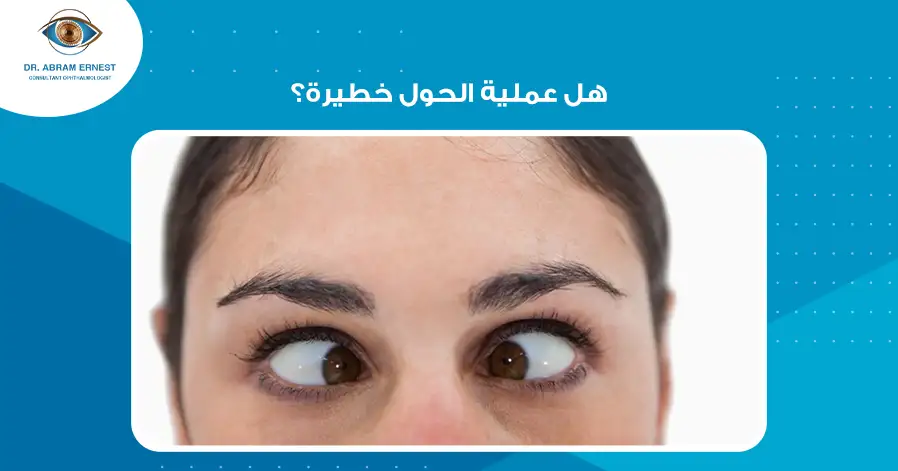 هل عملية الحول خطيرة؟