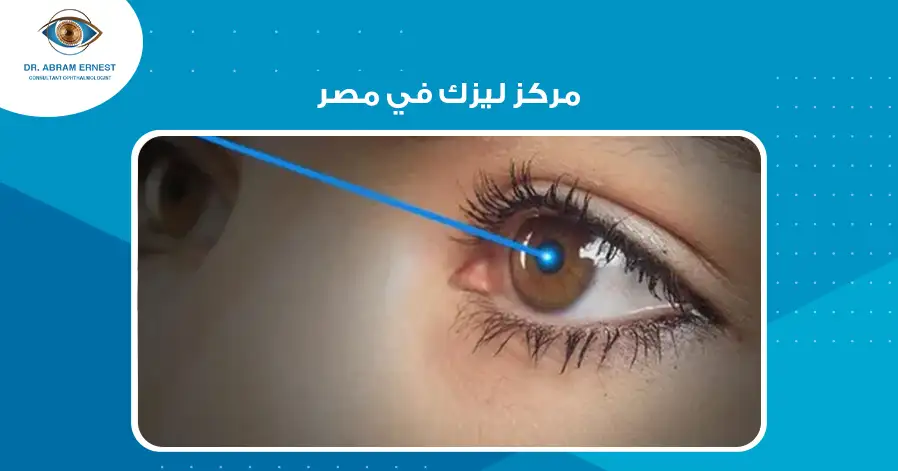 مركز ليزك في مصر