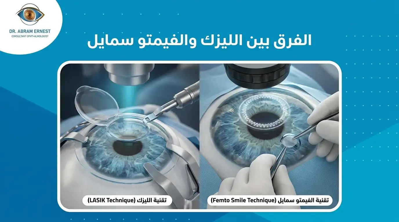 الفرق بين الليزك والفيمتو سمايل