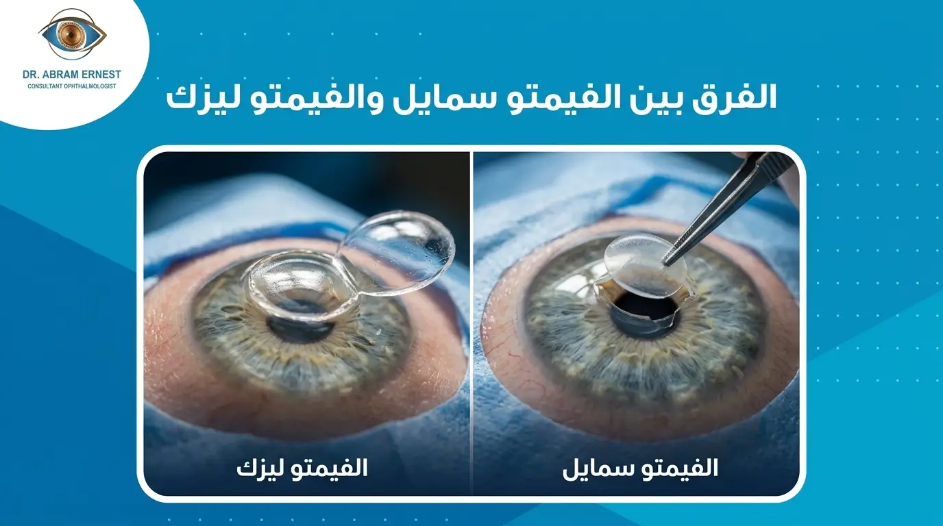 الفرق بين فيمتو سمايل والفيمتو ليزك