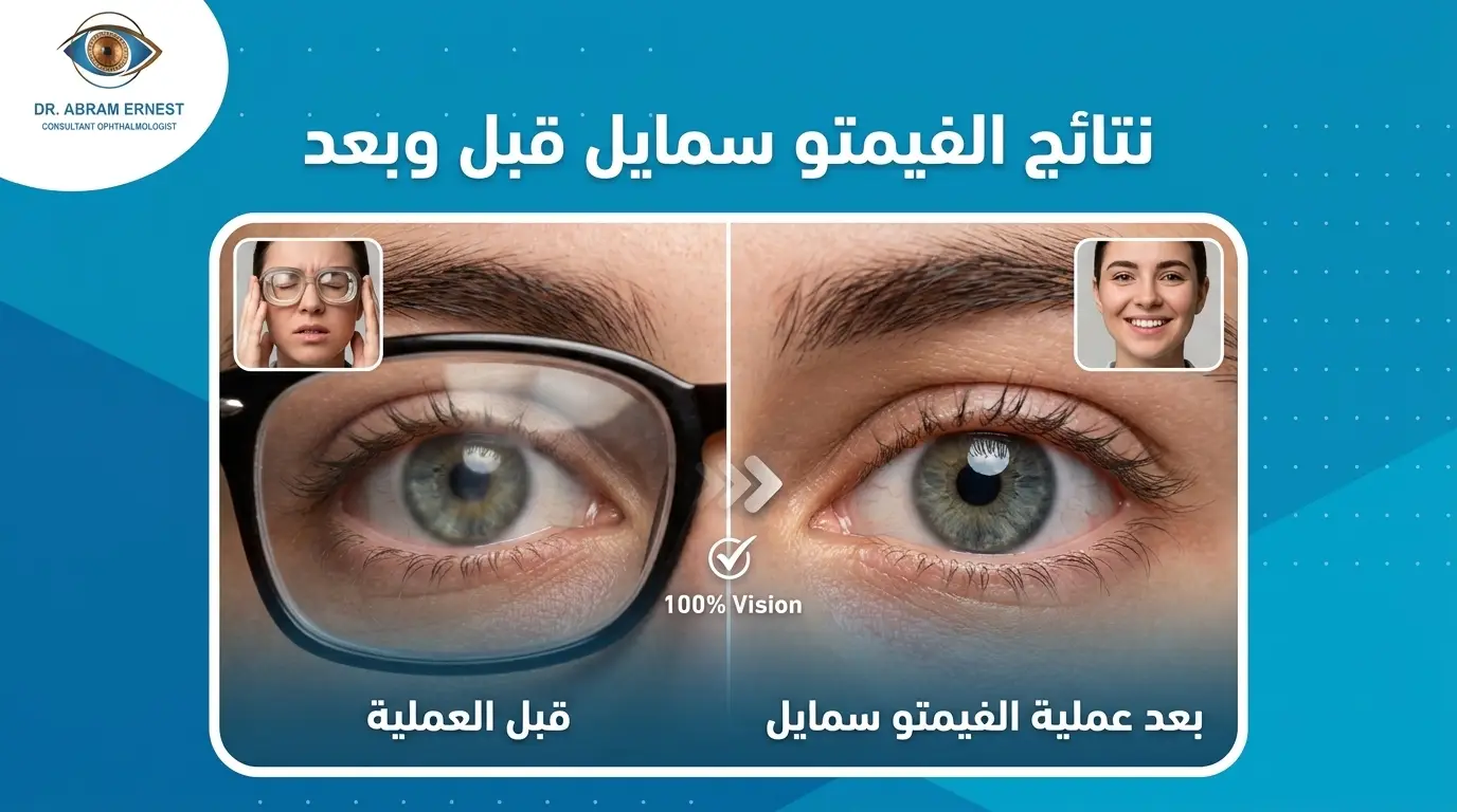 نتائج عملية فيمتو سمايل قبل وبعد
