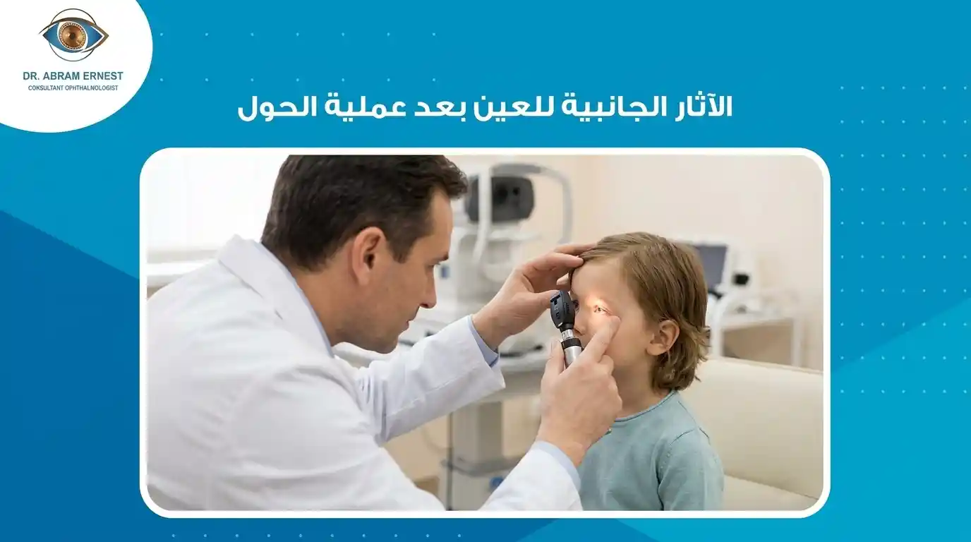 الآثار الجانبية للعين بعد عملية الحول
