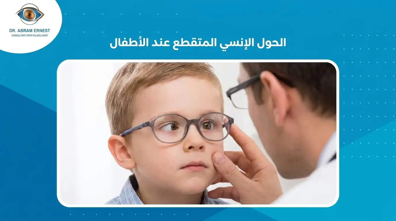 الحول الإنسي المتقطع عند الأطفال