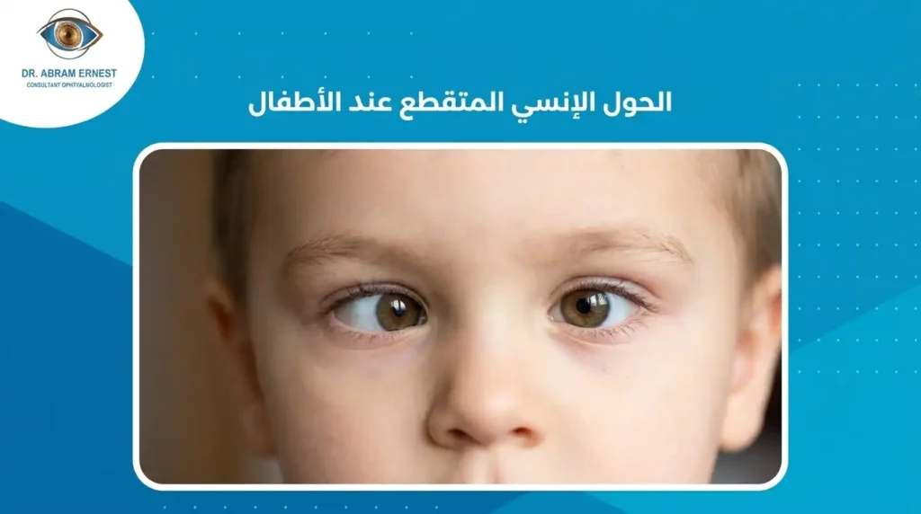 الحول الإنسي المتقطع عند الأطفال