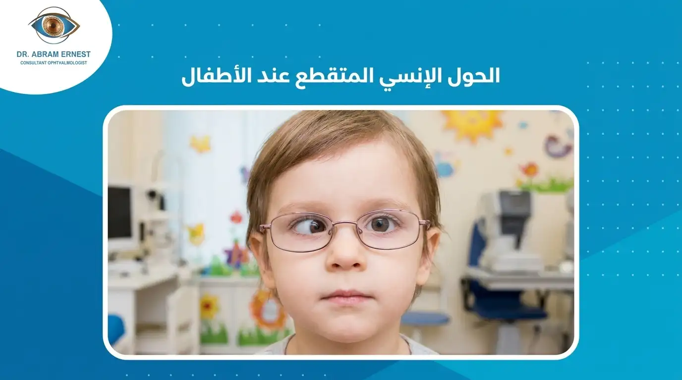 الحول الإنسي المتقطع عند الأطفال
