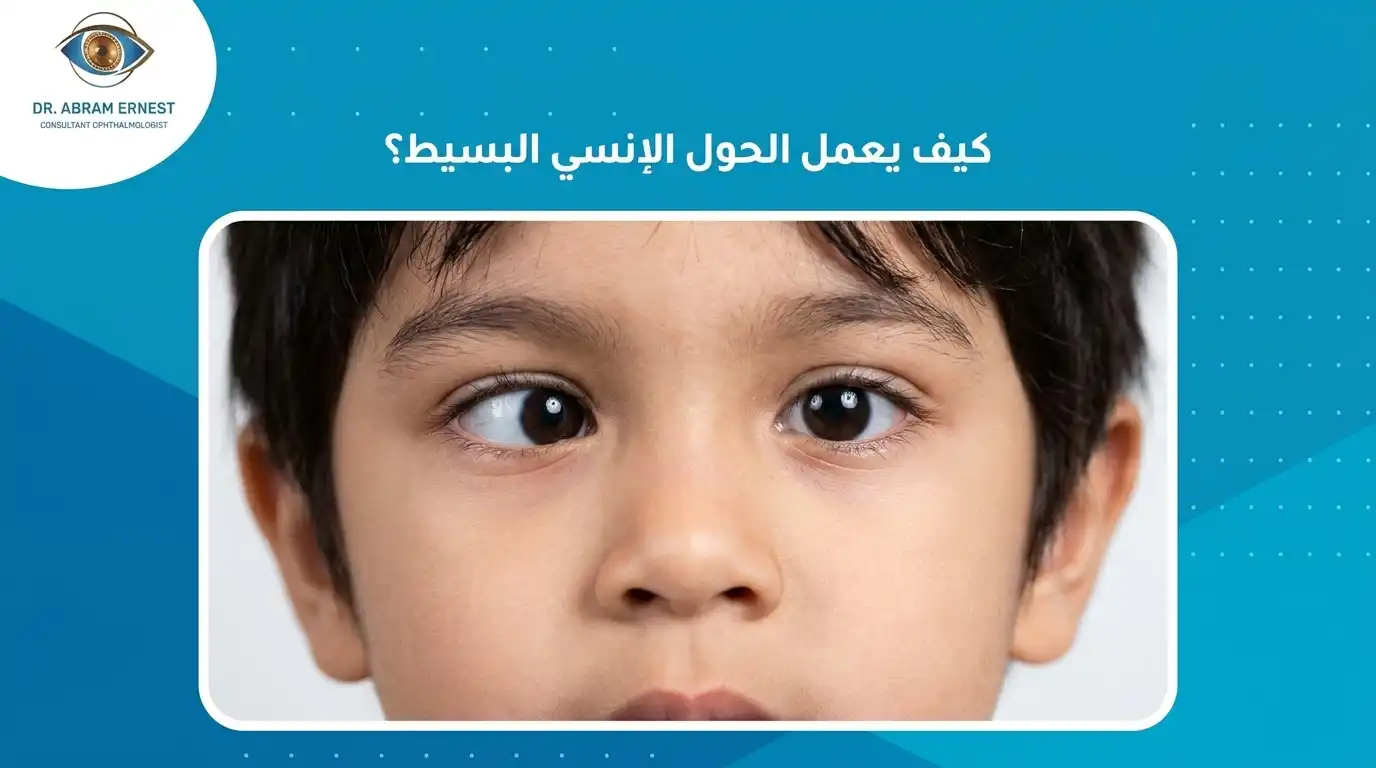 كيف تتم عملية الحول الإنسي البسيط