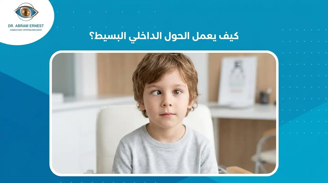 كيف تتم عملية الحول الإنسي البسيط