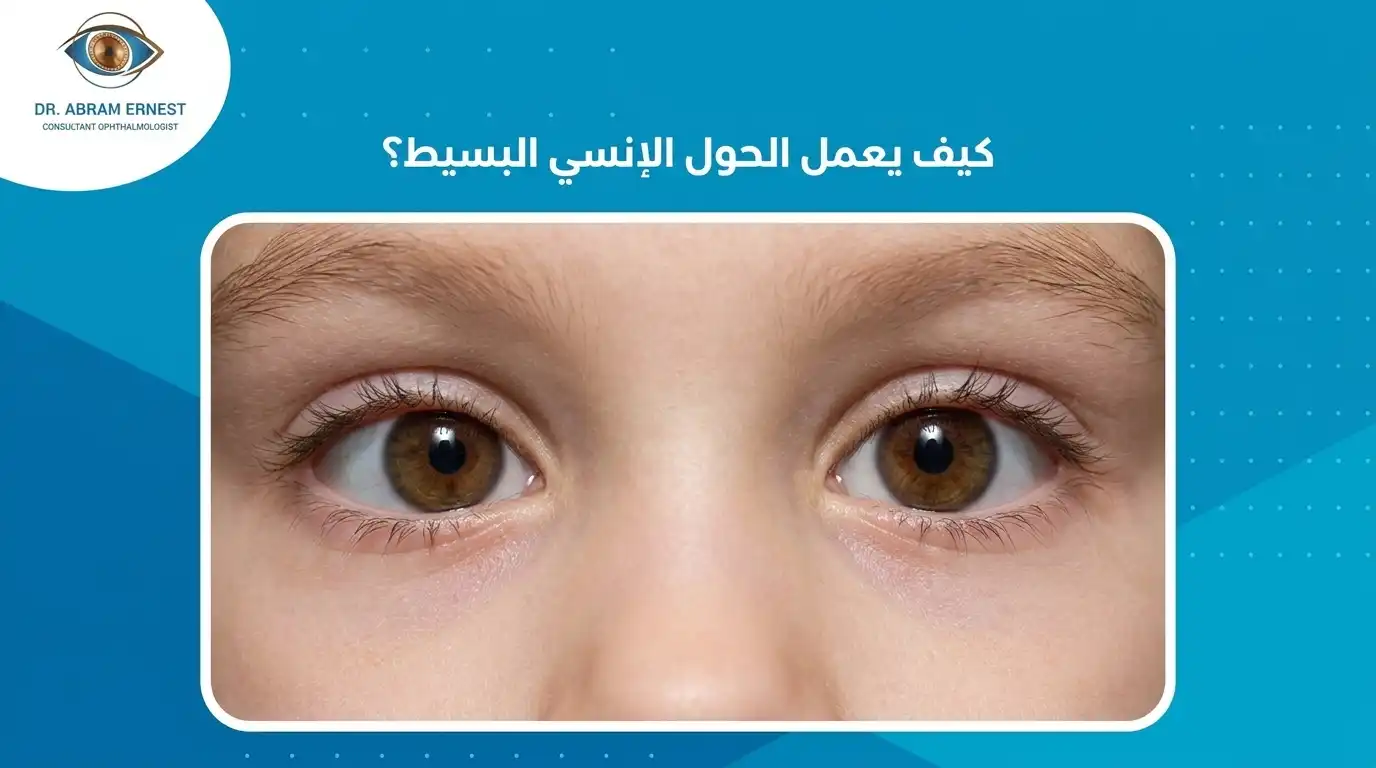 كيف تتم عملية الحول الإنسي البسيط