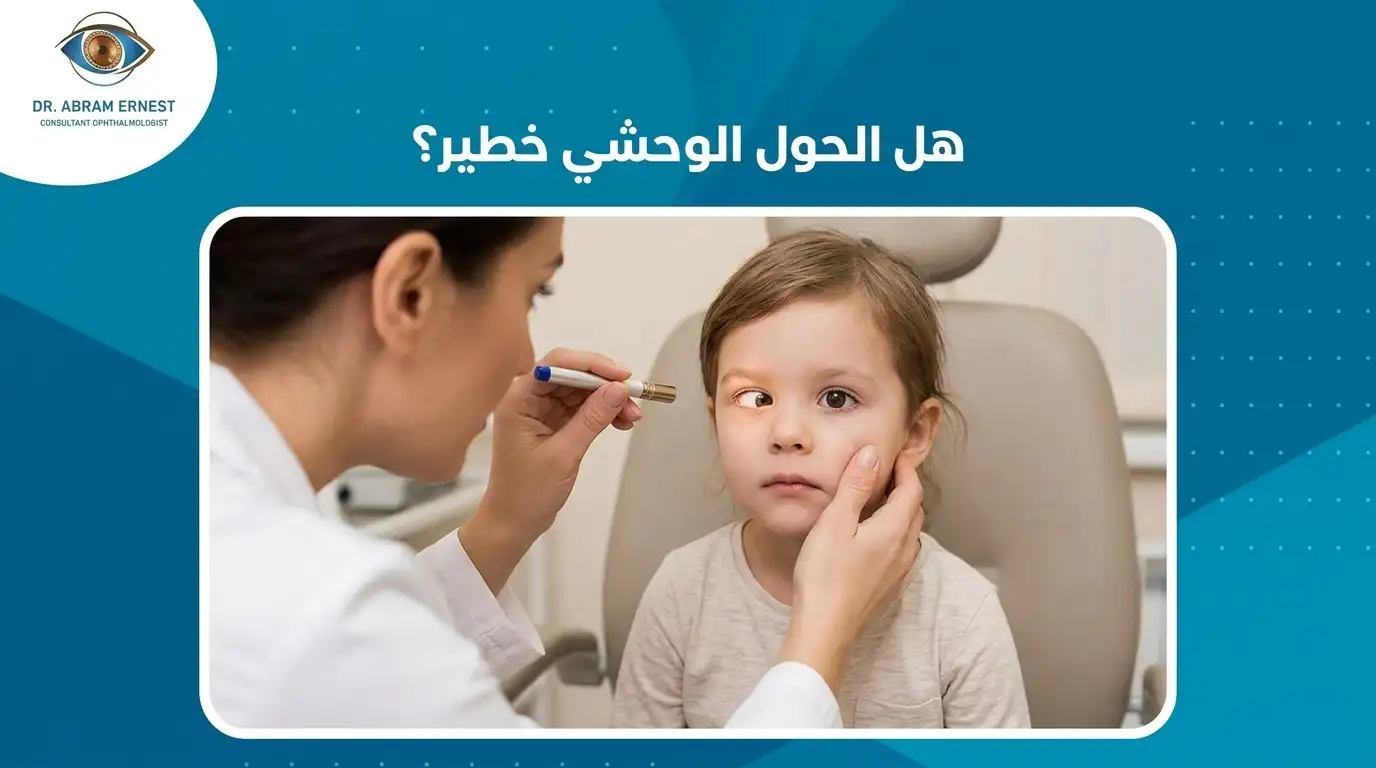 هل الحول الوحشي خطير؟
