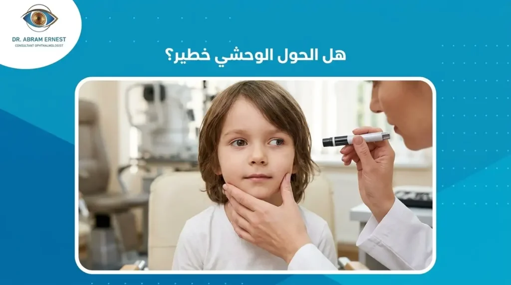 هل الحول الوحشي خطير؟