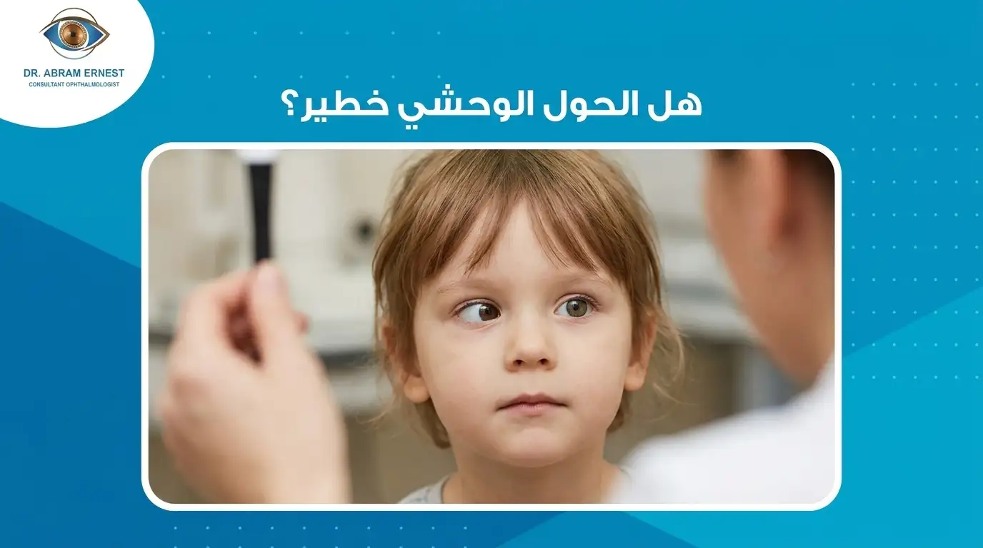 هل الحول الوحشي خطير؟