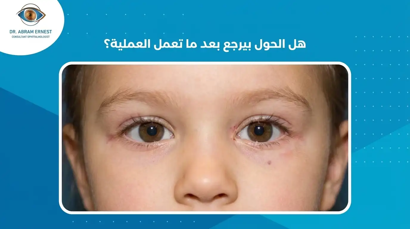 هل الحول بيرجع بعد ما تعمل العملية؟