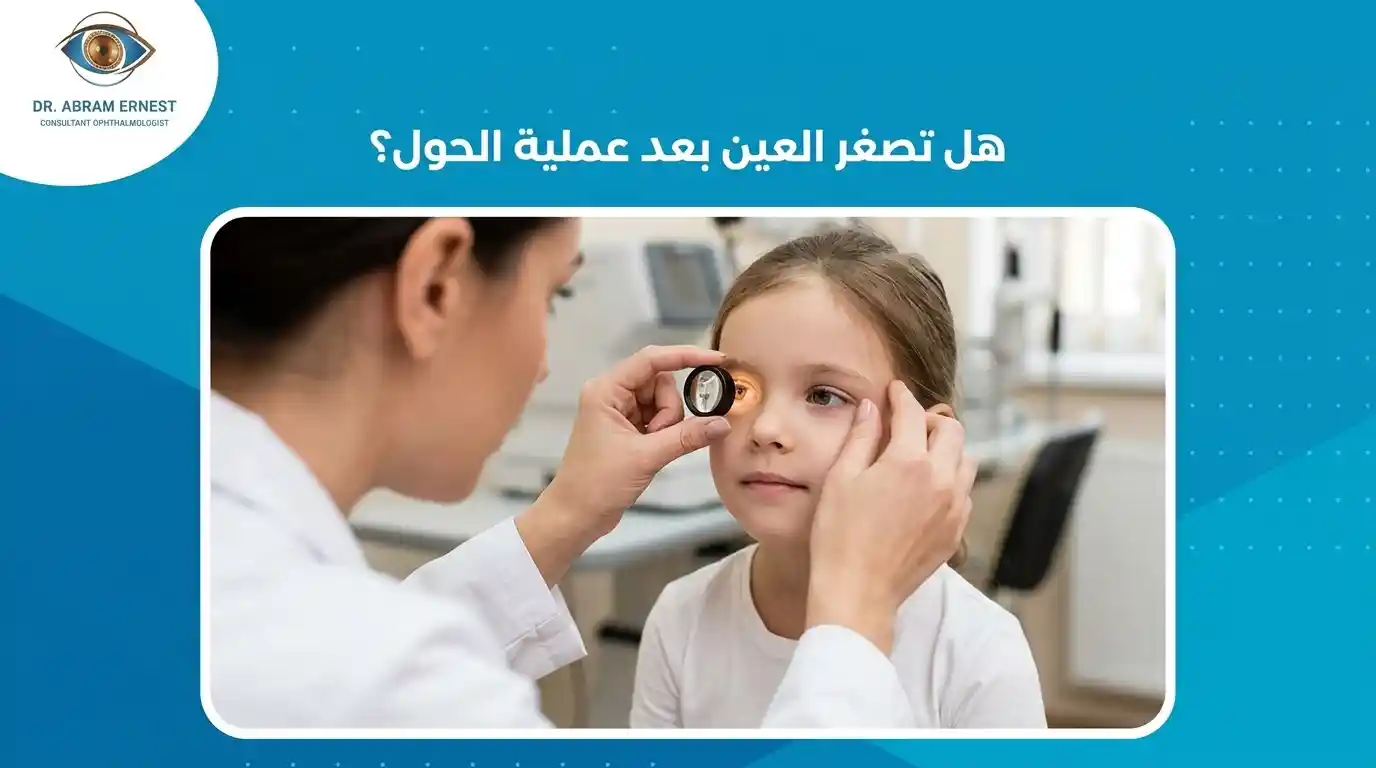 هل تصغر العين بعد عملية الحول؟
