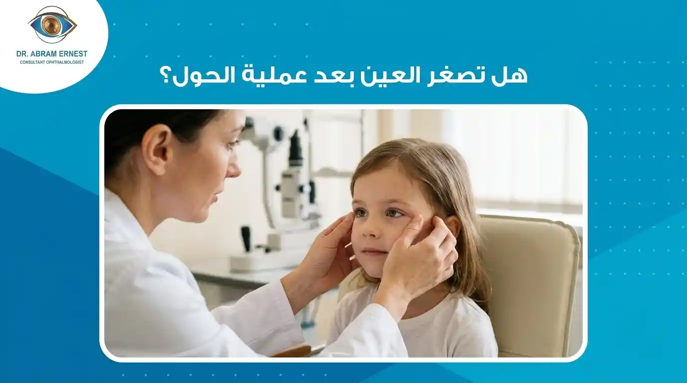 هل تصغر العين بعد عملية الحول؟