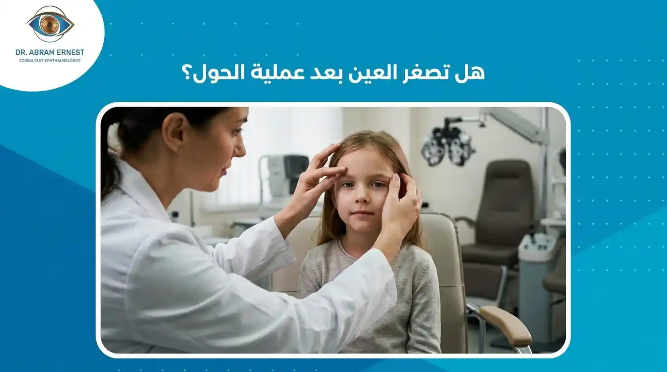 هل تصغر العين بعد عملية الحول؟