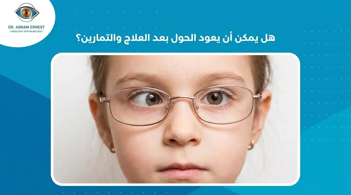 هل يمكن أن يعود الحول بعد العلاج والتمارين؟