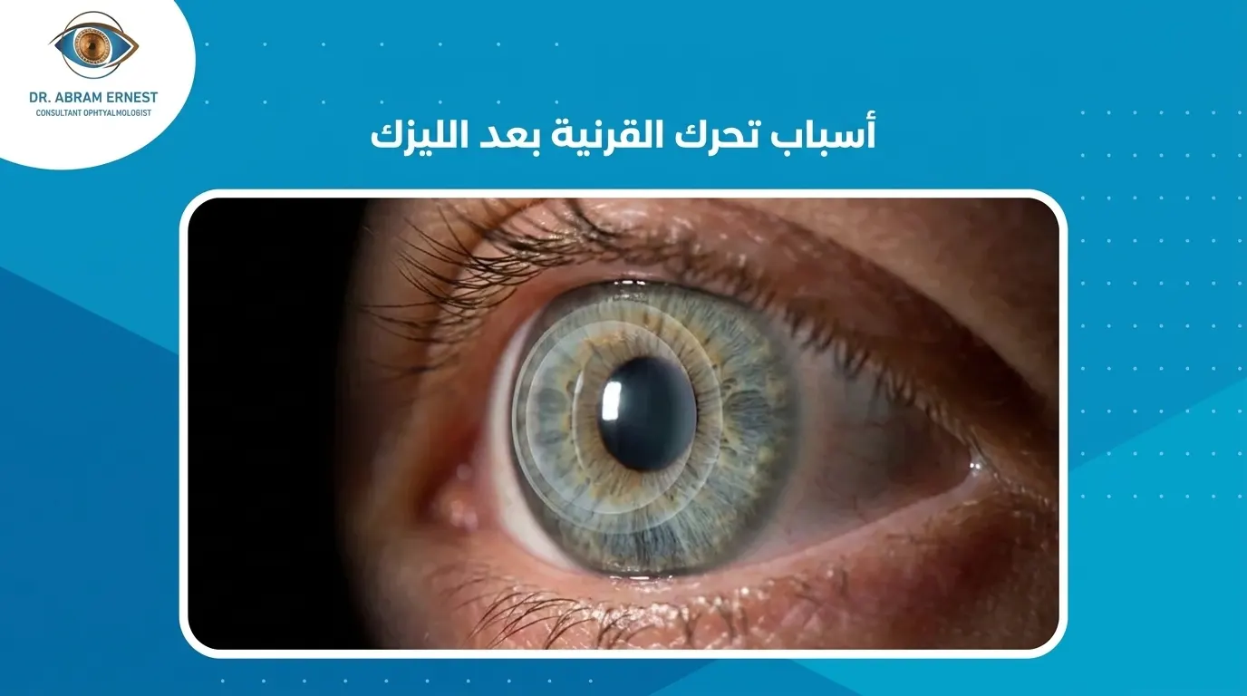 أسباب تحرك القرنية بعد الليزك