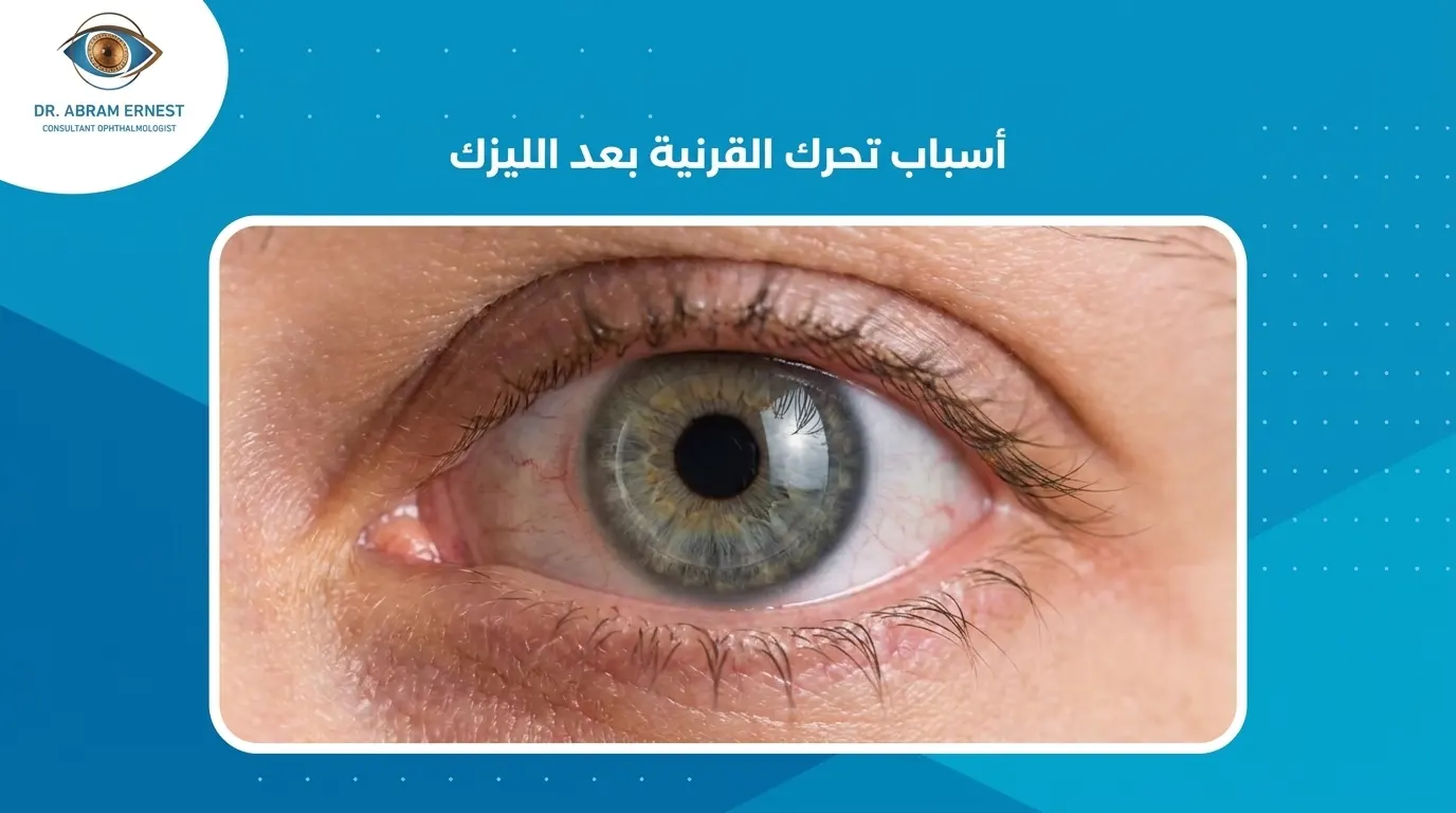 أسباب تحرك القرنية بعد الليزك