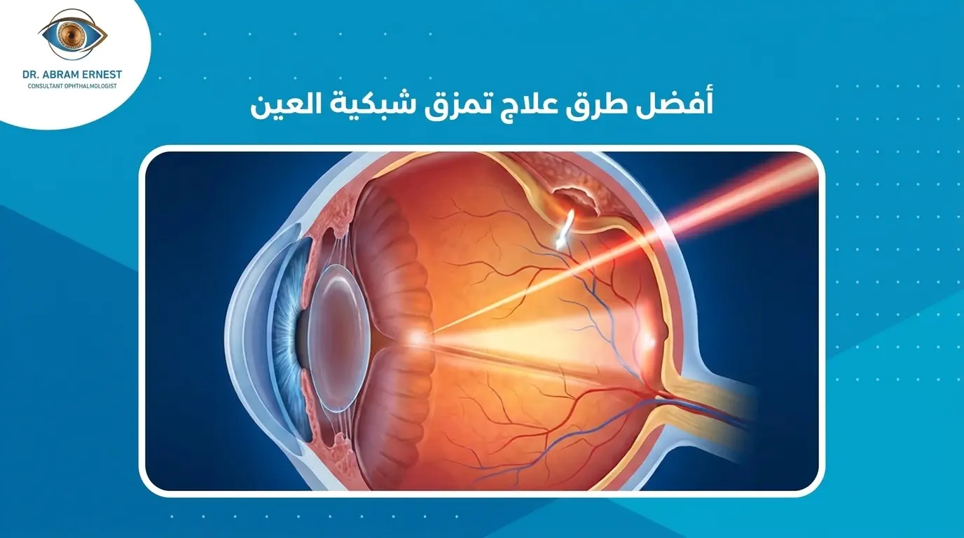 أفضل طرق علاج تمزق شبكية العين