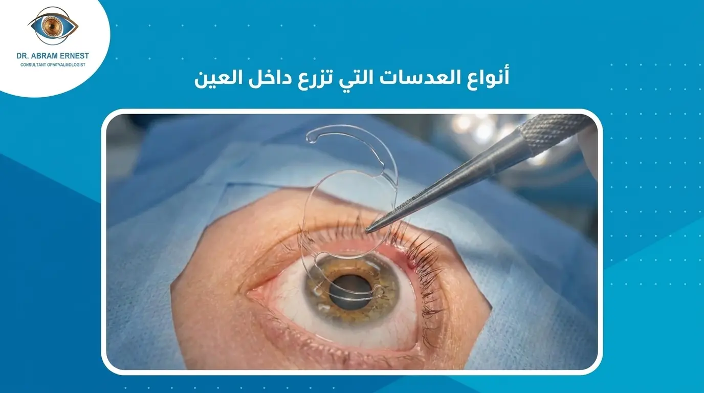 أنواع العدسات التي تزرع داخل العين