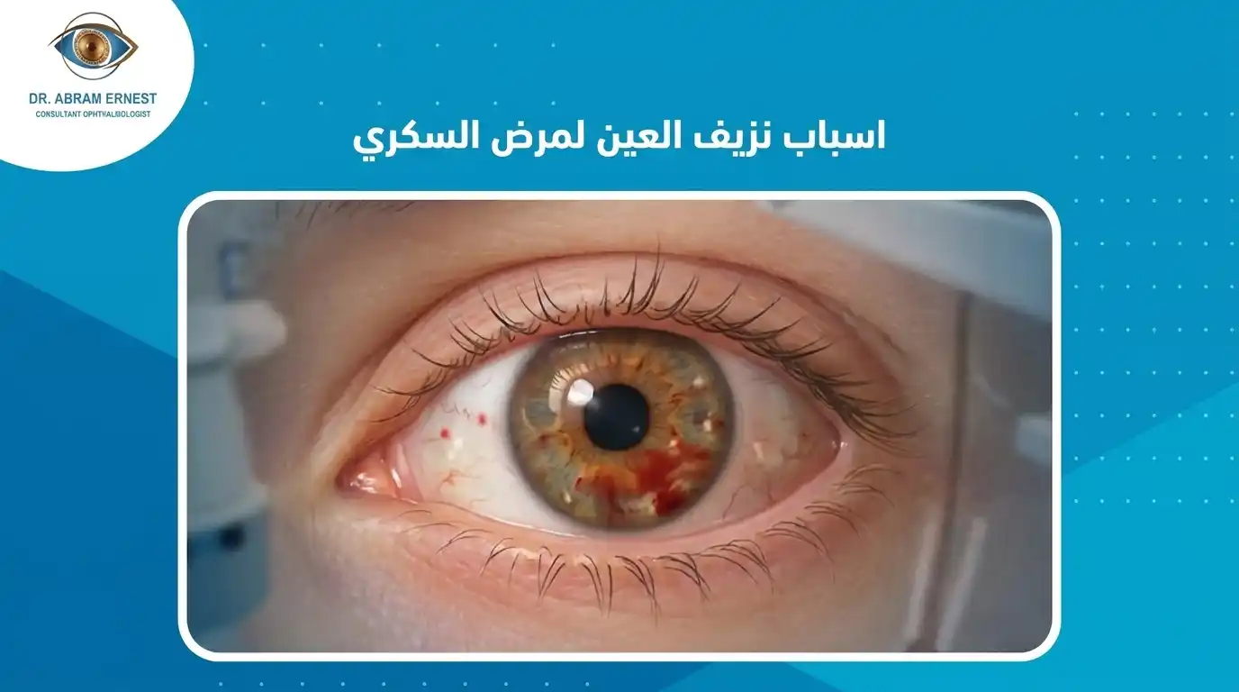 اسباب نزيف العين لمرض السكري