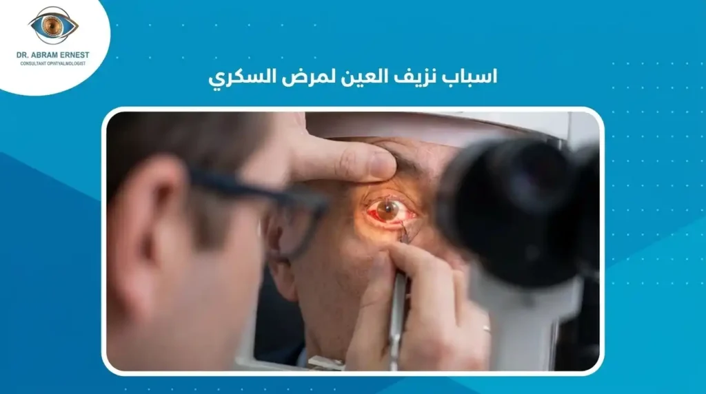اسباب نزيف العين لمرض السكري