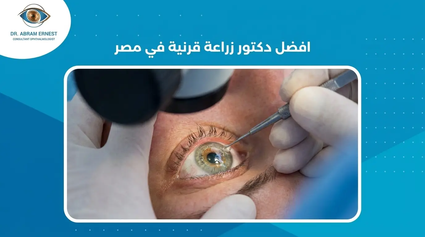 افضل دكتور زراعة قرنية في مصر
