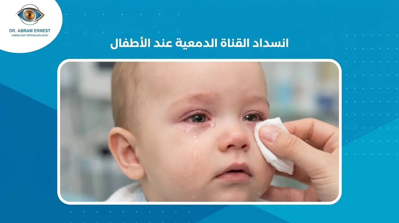 انسداد القناة الدمعية عند الأطفال