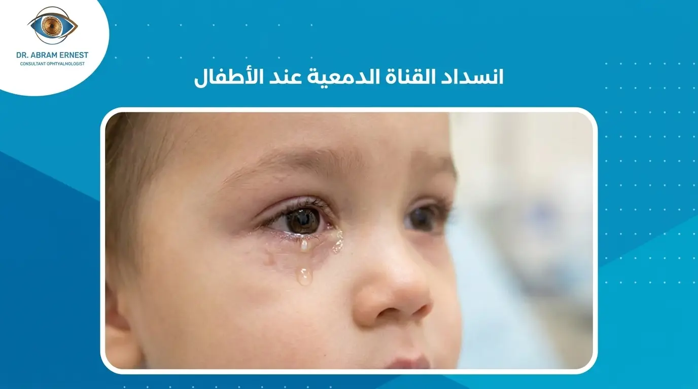 انسداد القناة الدمعية عند الأطفال