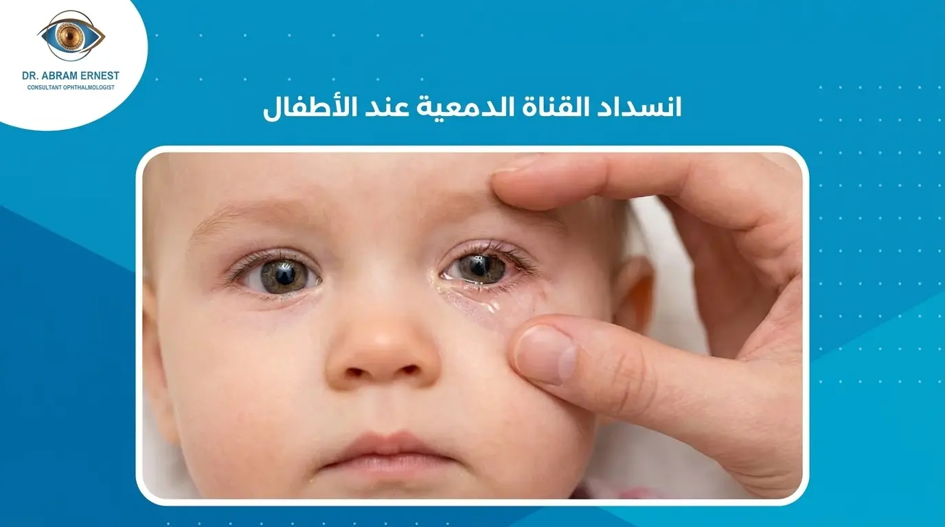 انسداد القناة الدمعية عند الأطفال