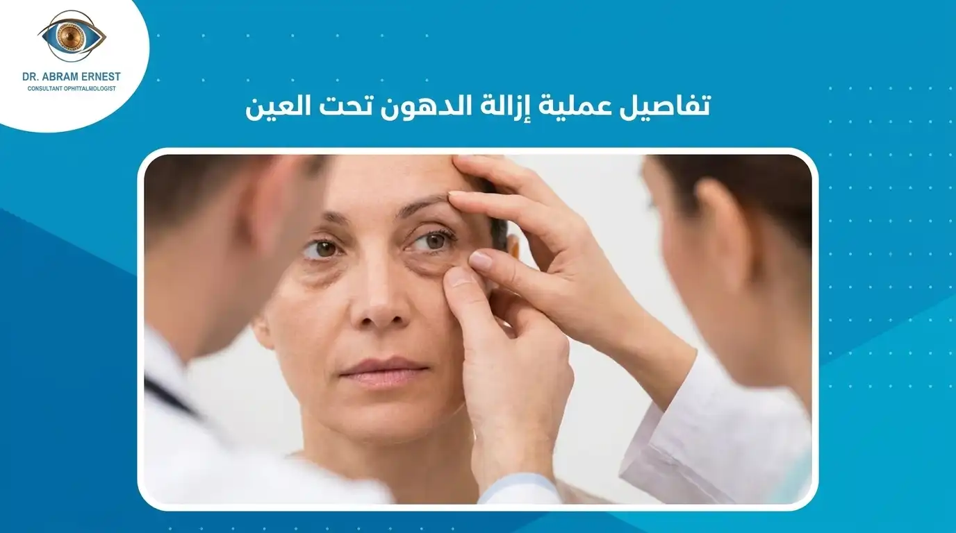 تفاصيل عملية إزالة الدهون تحت العين