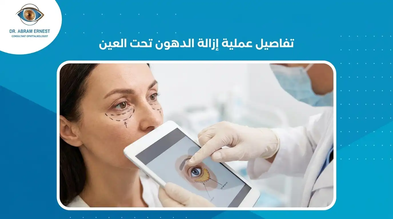 تفاصيل عملية إزالة الدهون تحت العين