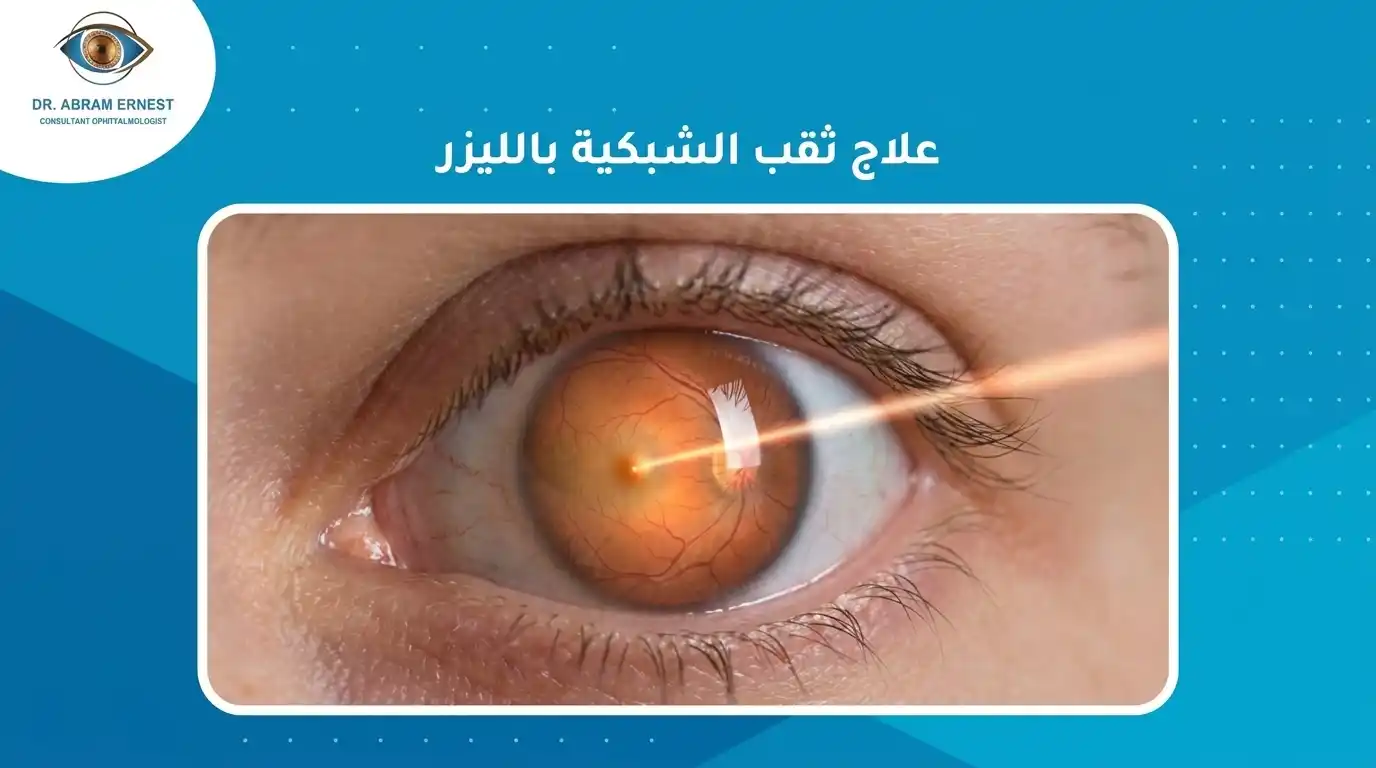 علاج ثقب الشبكية بالليزر