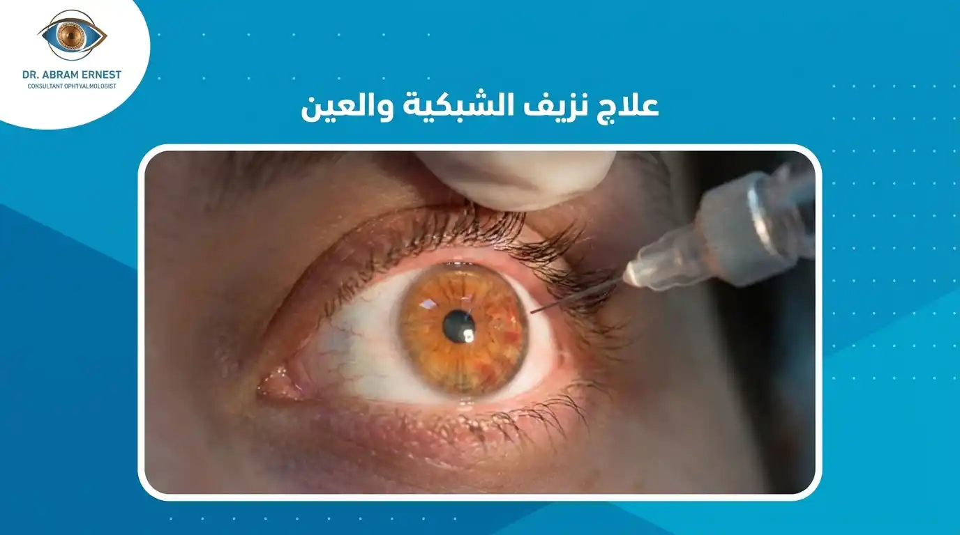 علاج نزيف الشبكية والعين